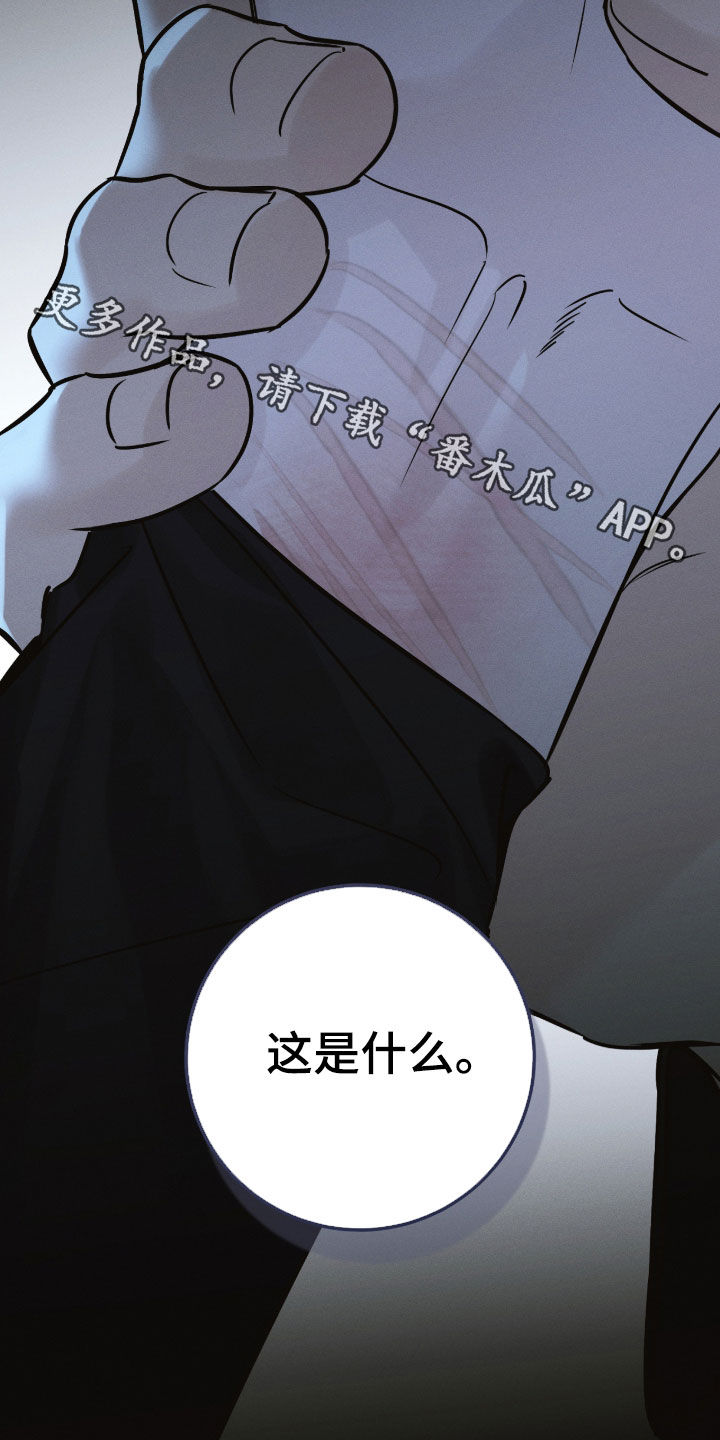 冬夜回响漫画,第29章：伤痕2图