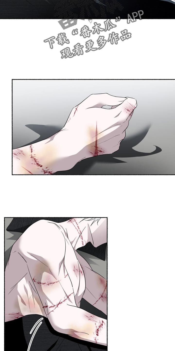 心跳共鸣漫画,第33章：不死之身3图