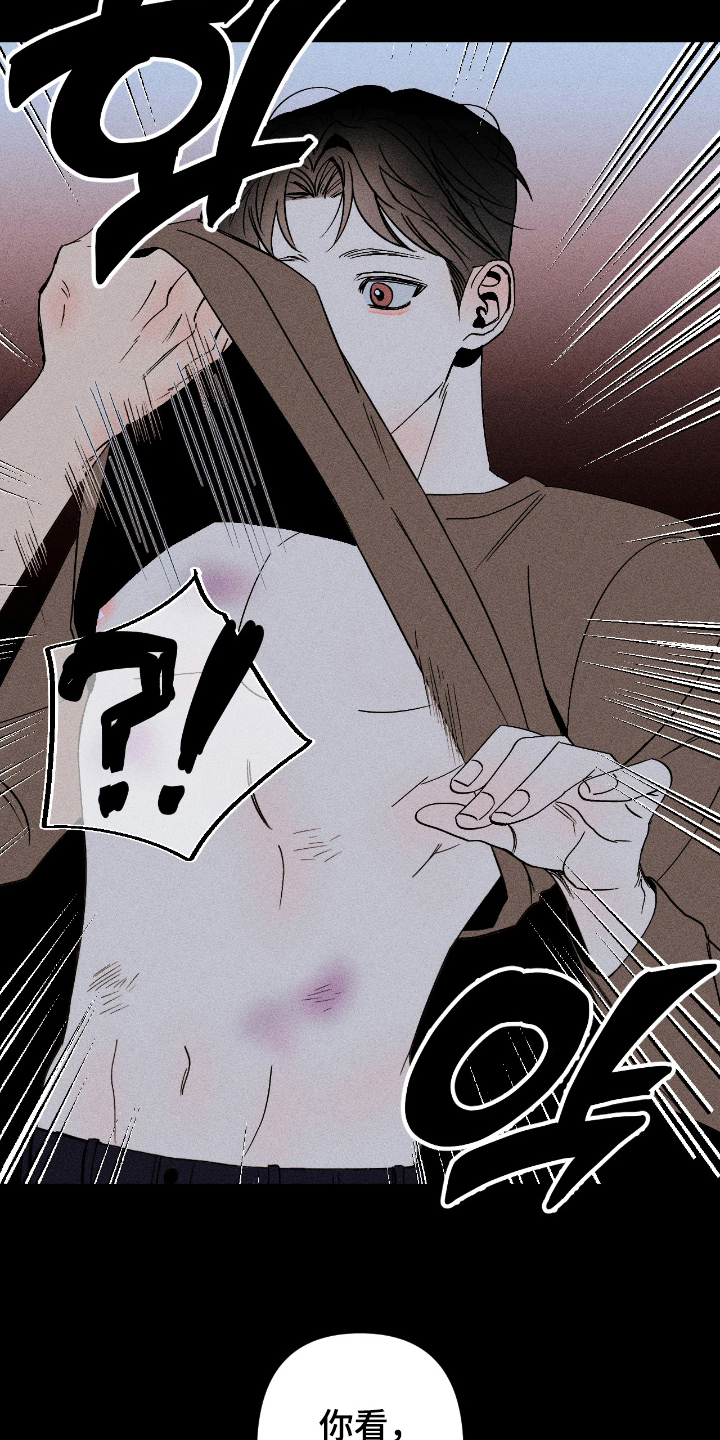 吻的创伤漫画,第9章：担心2图