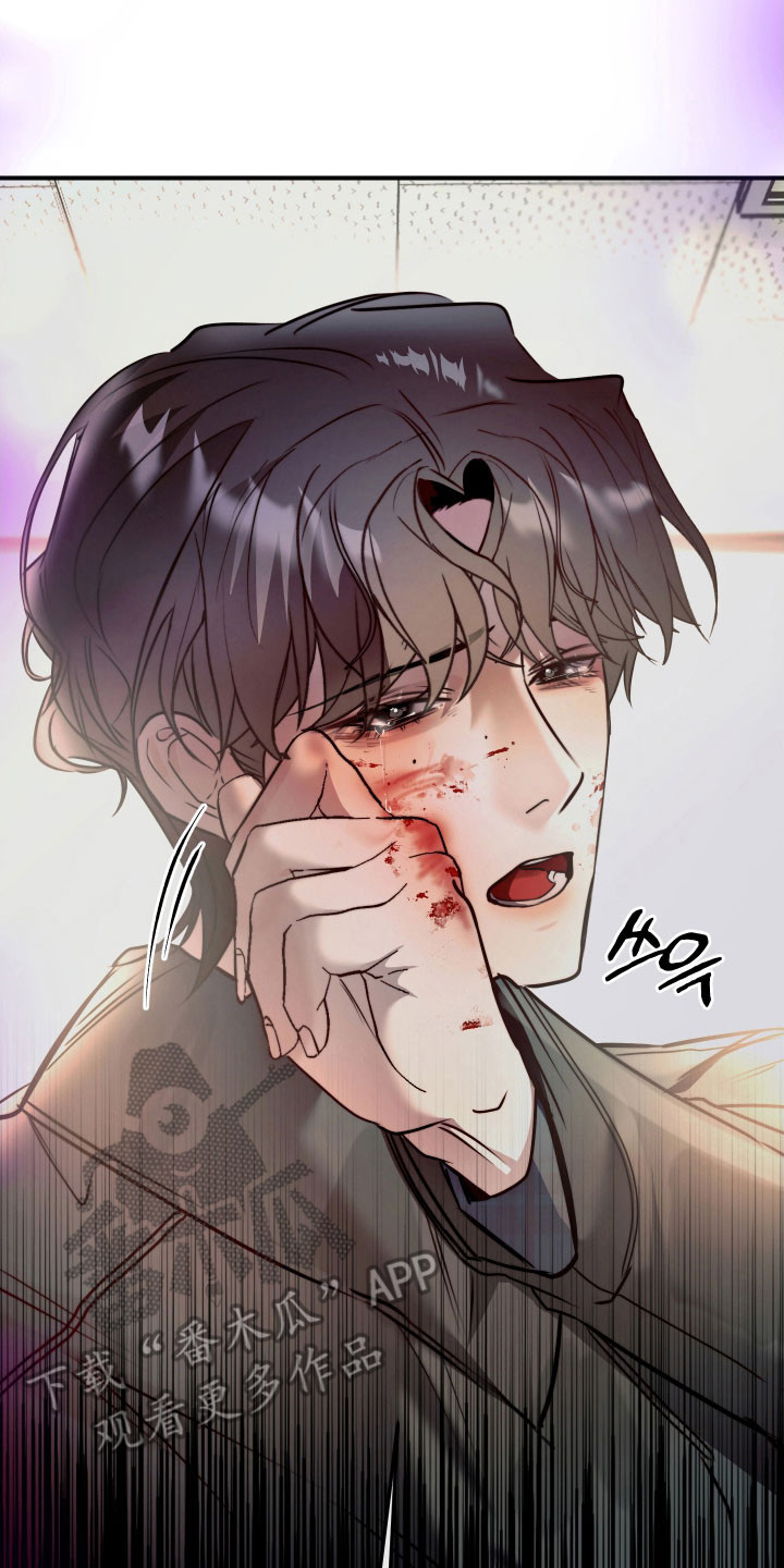 伪爱迷局精彩台词漫画,第17章：下手太重5图